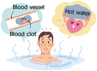 Bathing in hot water